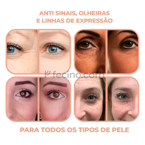 Sérum™ - Anti Sinais, Olheiras e Linhas de Expressão (Compre 1, Leve 2)